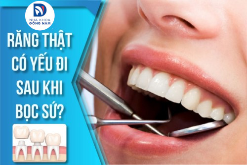 Bọc Răng Sứ có làm cho răng thật yếu đi không?