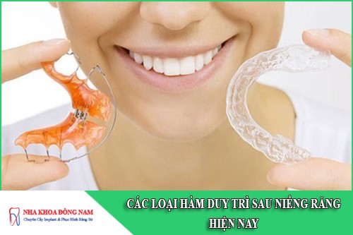 các loại hàm duy trì sau niềng răng hiện nay