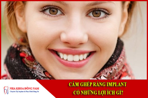 Cấy ghép Implant có những lợi ích gì