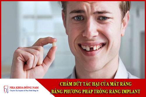 Chấm dứt tác hại của mất răng bằng phương pháp trồng răng implant