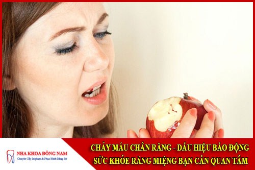 Chảy máu chân răng dấu hiệu báo động sức khỏe răng miệng