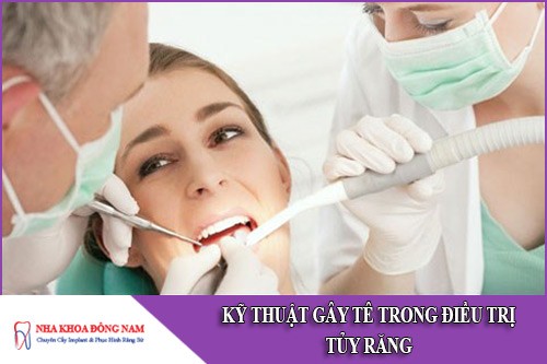kỹ thuật gây tê trong điều trị tủy răng