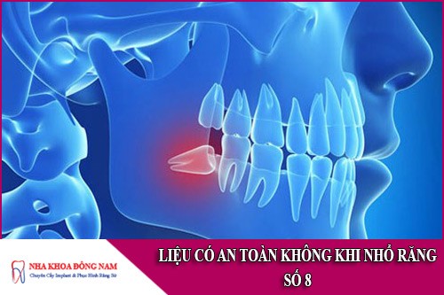 liệu có an toàn không khi nhổ răng số 8