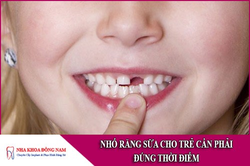 nhổ răng sữa cho trẻ cần phải đúng thời điểm