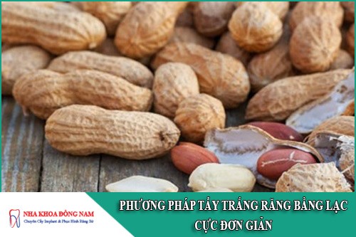 phương pháp tẩy trắng răng bằng lạc