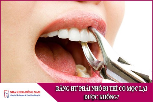 răng hư phải nhổ đi thì có mọc lại được không