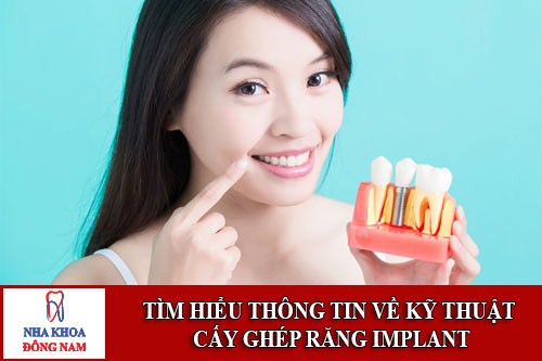 Tìm hiểu về kỹ thuật cấy ghép răng Implant