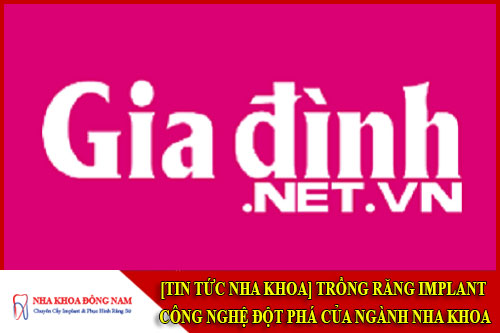 Trồng răng implant công nghệ đột phá trong ngành nha