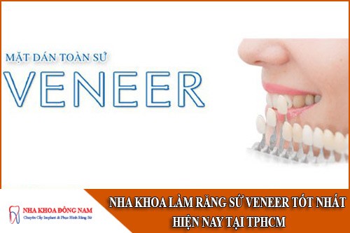 nha khoa làm răng sứ veneer tốt nhất hiện nay tại tphcm