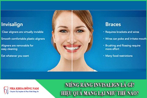 niềng răng invisalign hiệu quả như thế nào