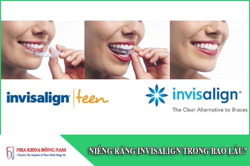 niềng răng invisalign trong bao lâu