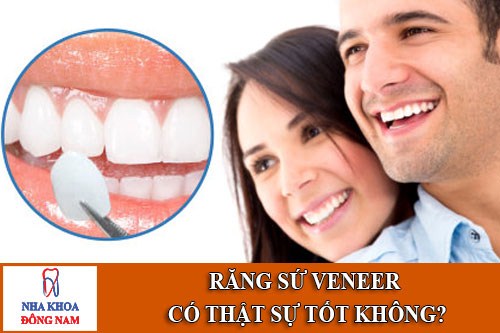 Răng sứ Veneer có thật sự tốt không