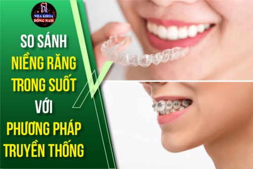 So Sánh Niềng Răng Trong Suốt Với Phương Pháp Truyền Thống