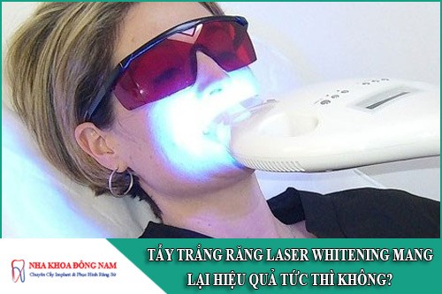 tẩy trắng răng laser whitening