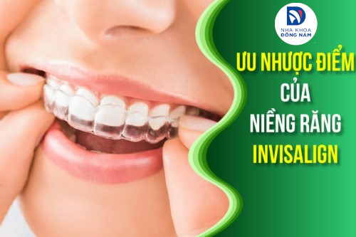 Ưu nhược điểm của Niềng Răng Invisalign