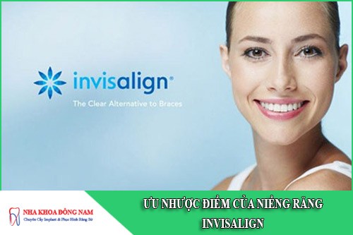 ưu nhược điểm của niềng răng invisalign