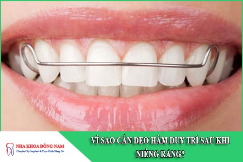 vì sao cần đeo hàm duy trì sau khi niềng răng