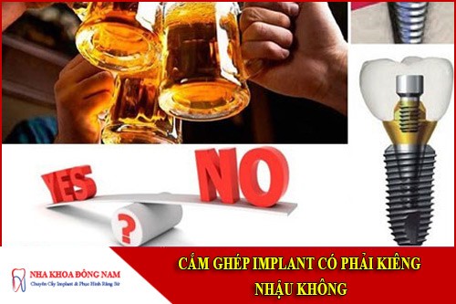 cắm implant có phải kiêng nhậu không
