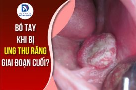 bó tay khi bị ung thư răng giai đoạn cuối