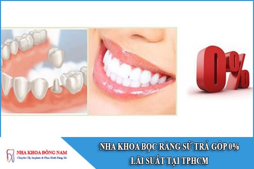 nha khoa bọc răng sứ trả góp 0% lãi suất tại tphcm