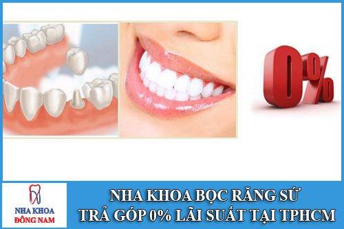 Nha khoa bọc răng sứ trả góp 0% lãi xuất tại TpHCM