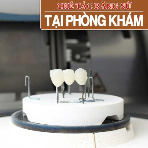 chế tác răng sứ tại nha khoa đông Nam