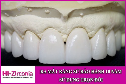 Ra mắt răng sứ bảo hành 10 năm sử dụng trọn đời