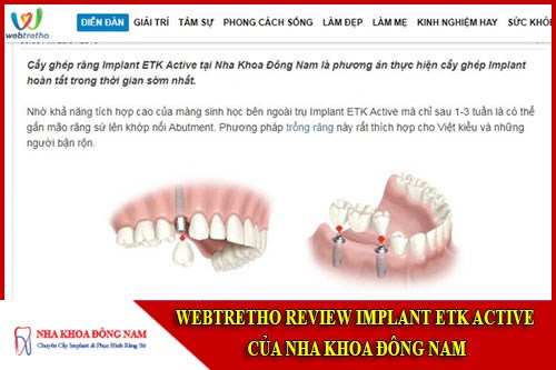 Webtretho review implant etk active của nha khoa Đông Nam
