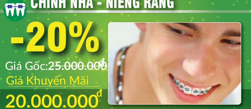 khuyến mãi niềng răng nhân dịp 30/04 1