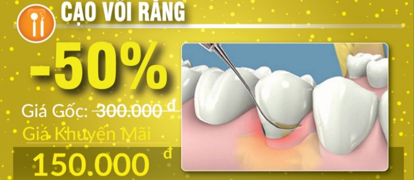 khuyến mãi cạo vôi răng nhân dịp 30/04