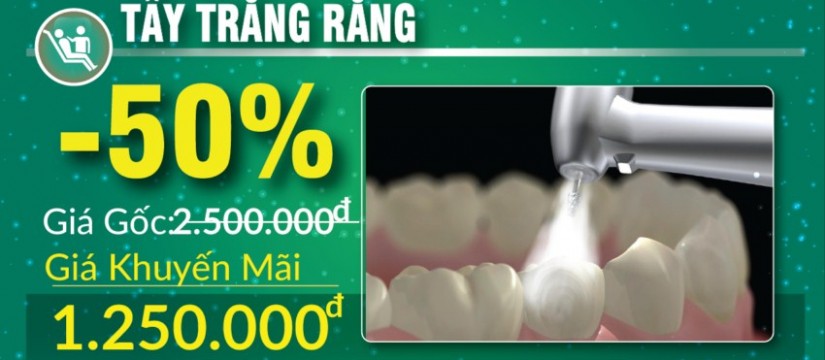 khuyến mãi tẩy trắng răng nhân dịp 30/04 1