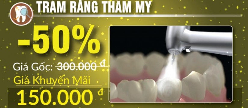 khuyến mãi trám răng nhân dịp 30/04 1