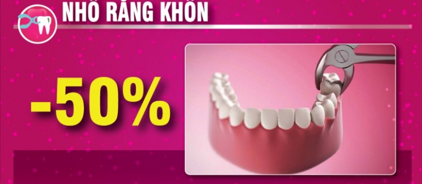 khuyến mãi nhổ răng nhân dịp 30/04 1