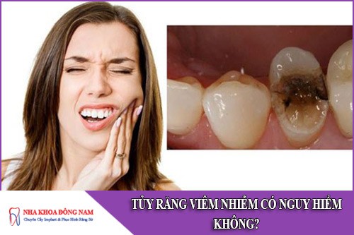 tủy răng bị viêm nhiễm có nguy hiểm không