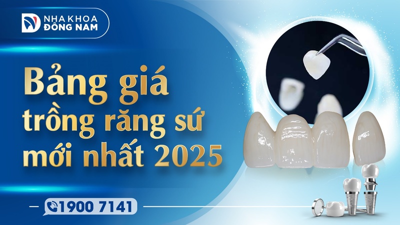 Bảng giá trồng răng sứ mới nhất 2025