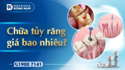 Chữa tủy răng giá bao nhiêu