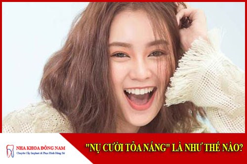 Nụ cười tỏa nắng là như thế nào