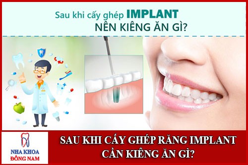 Sau khi cấy ghép răng implant cần kiêng ăn gì