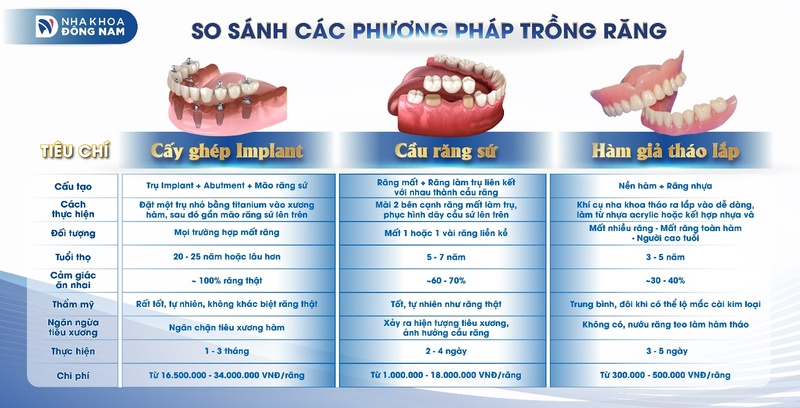 So sánh các phương pháp trồng răng