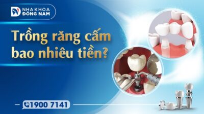 Trồng răng cấm bao nhiêu tiền