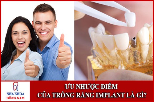 Ưu nhược điểm của cấy ghép implant là gì