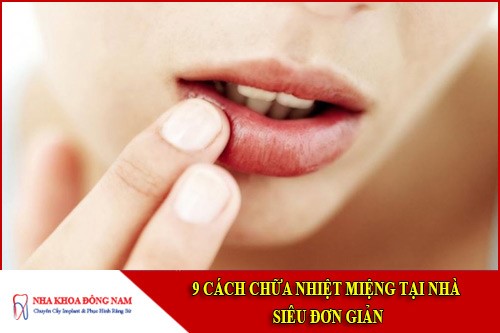 cách chữa nhiệt miệng tại nhà