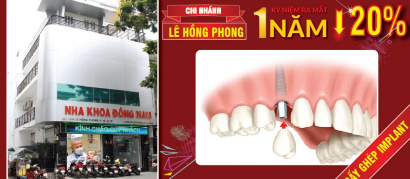 giảm giá cấy ghép implant kỷ niệm 1 năm ra mắt cơ lê hồng phong