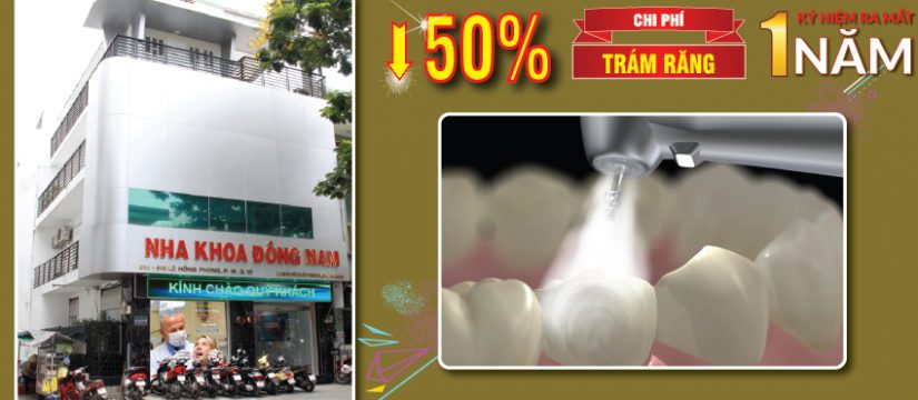 giảm 50% trám răng kỷ niệm 1 năm ra mắt cơ lê hồng phong