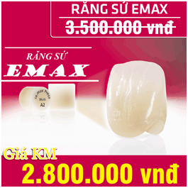 khuyến mãi răng toàn sứ emax