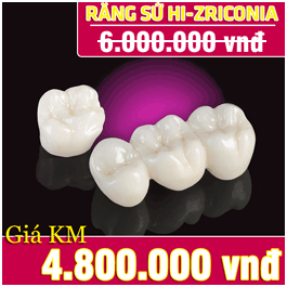 khuyến mãi răng toàn sứ hi-zirconia
