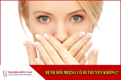 bệnh hôi miệng có di truyền không