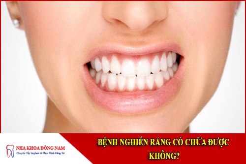bệnh nghiến răng có chữa được không