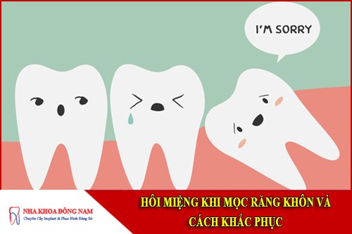 hôi miệng khi mọc răng khôn và cách khắc phục