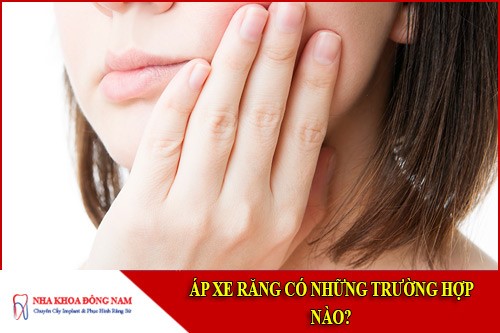 áp xe răng có những trường hợp nào